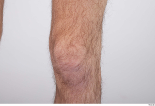 Dio hairy knee nude 0003.jpg